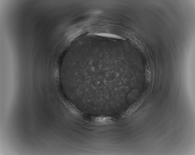X0000116440375200912151245