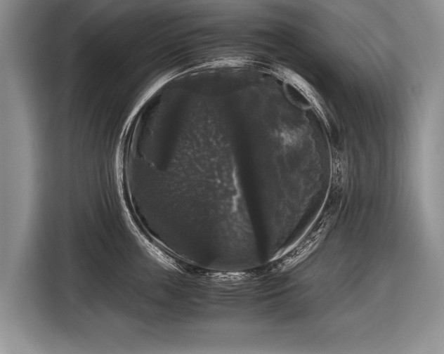 X0000116440859200912151239
