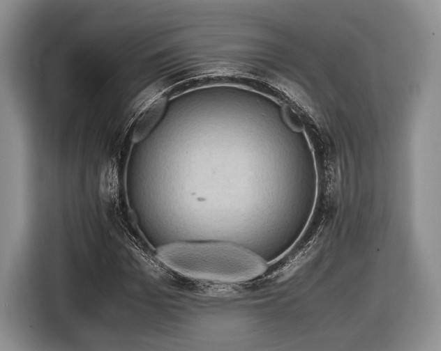 X0000116440969200912151237