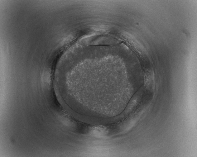 X0000116440215201001051211