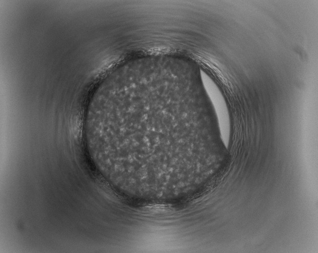 X0000116440499201001051207