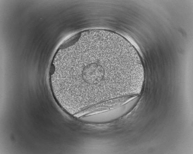 X0000116441197201001051159