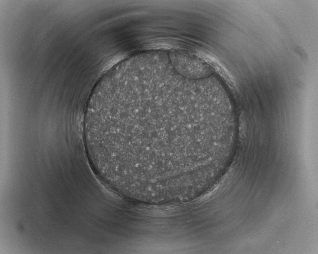 X0000116441233201001051158