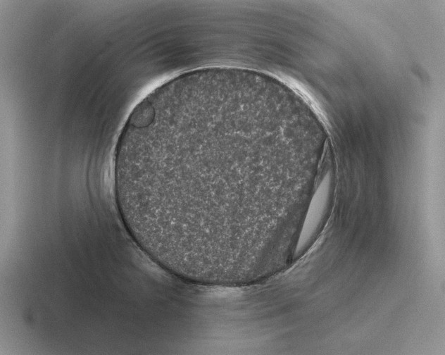 X0000116441238201001051158