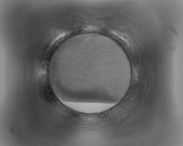 X0000116441254201001051158