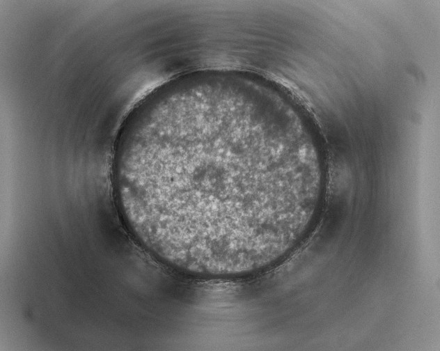 X0000116441314201001051157