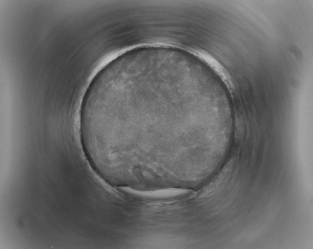 X0000116441335201001051157