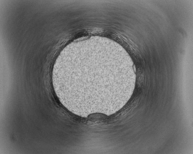 X0000116441345201001051157