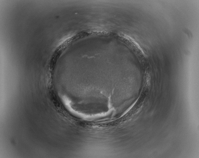 X0000116441350201001051157