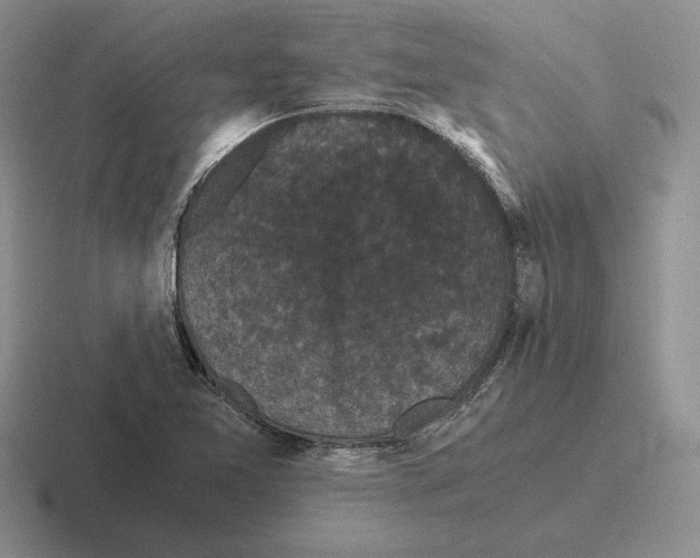 X0000116441365201001051156