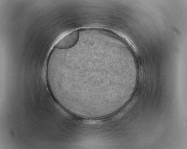 X0000116441374201001051156