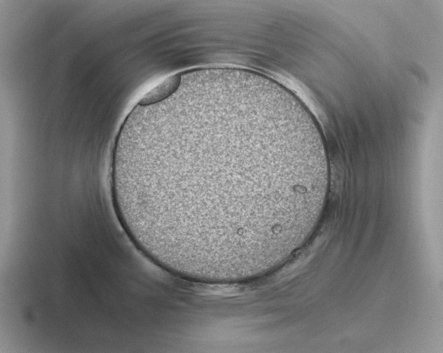 X0000116441387201001051156