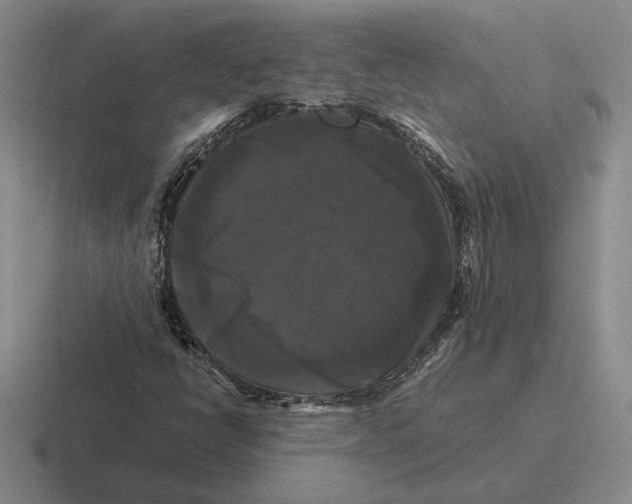 X0000116441398201001051156