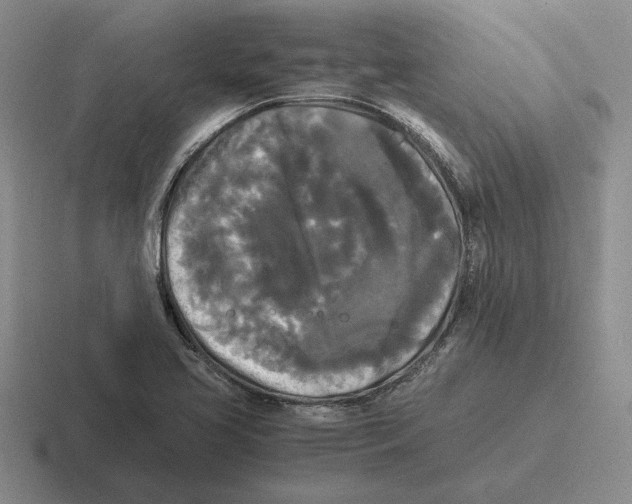 X0000116441413201001051156