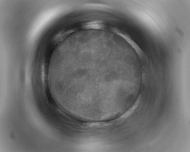 X0000116441438201001051156