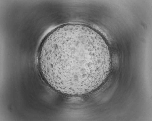 X0000116441462201001051155