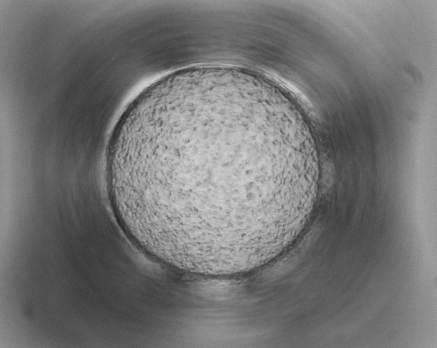 X0000116441470201001051155