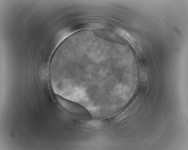 X0000116441473201001051155