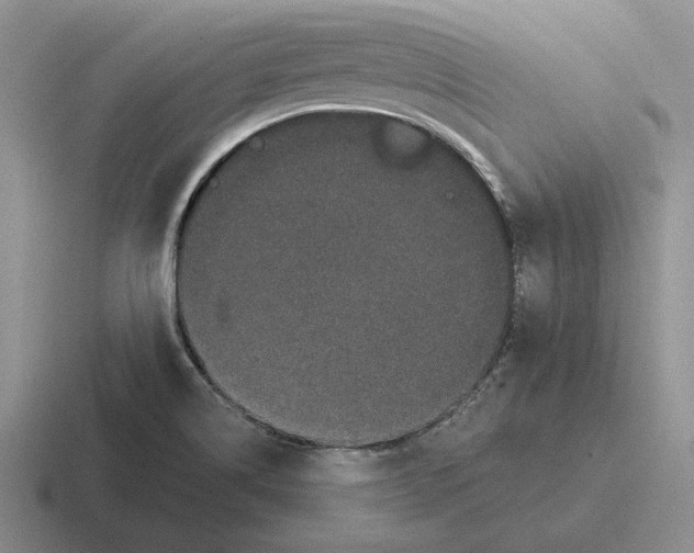 X0000116441514201001051155