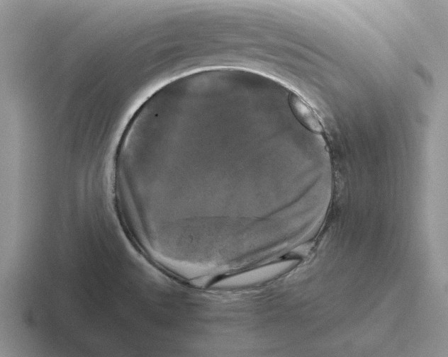 X0000116441527201001051155