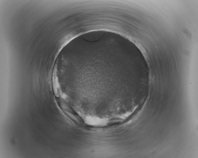 X0000116441529201001051155