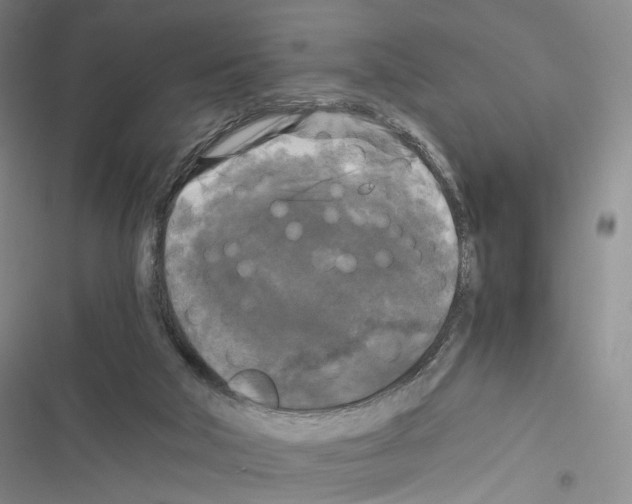 X0000116440018201001191541