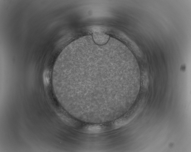 X0000116440075201001191540