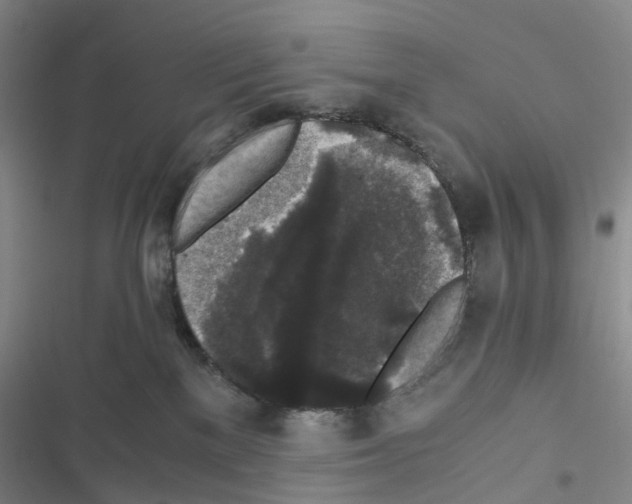 X0000116440137201001191540