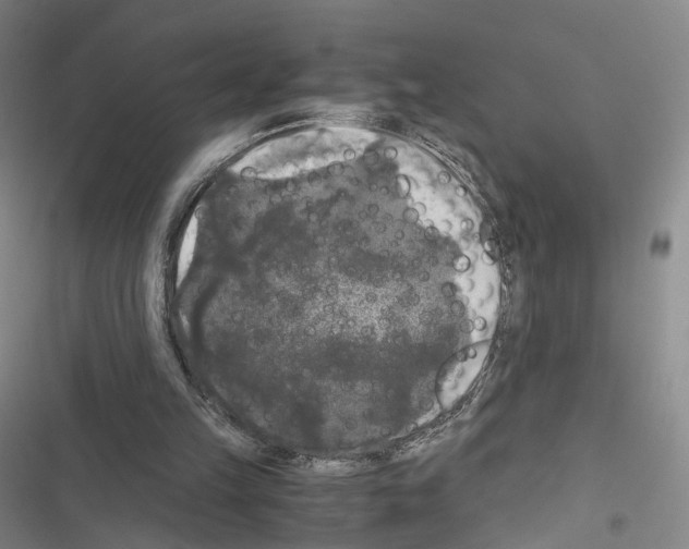 X0000116440149201001191539