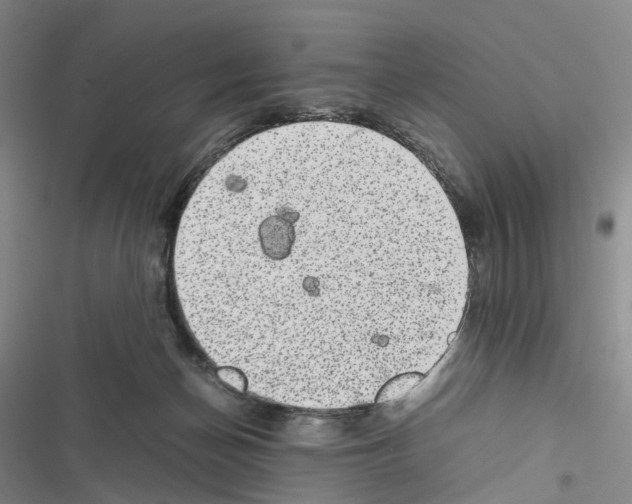 X0000116440174201001191539