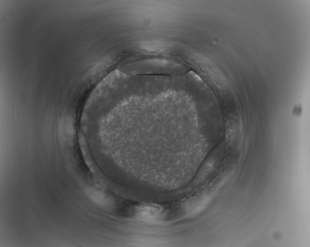 X0000116440215201001191538