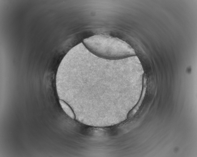 X0000116440229201001191538