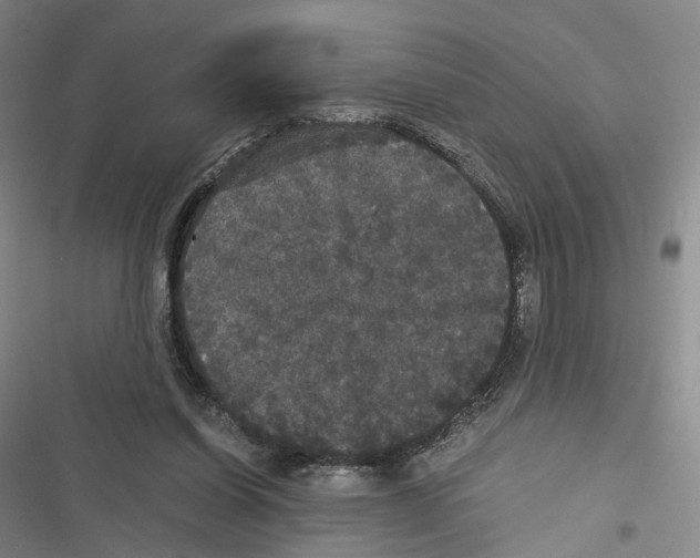 X0000116440254201001191538