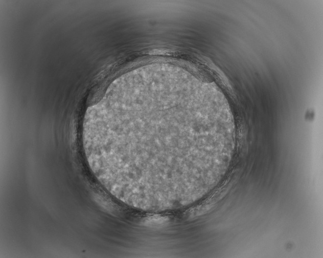 X0000116440257201001191538