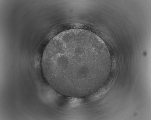 X0000116440274201001191538