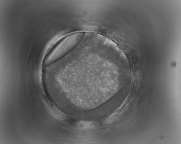 X0000116440294201001191537