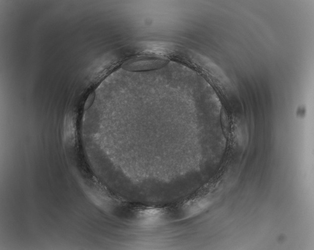 X0000116440312201001191537