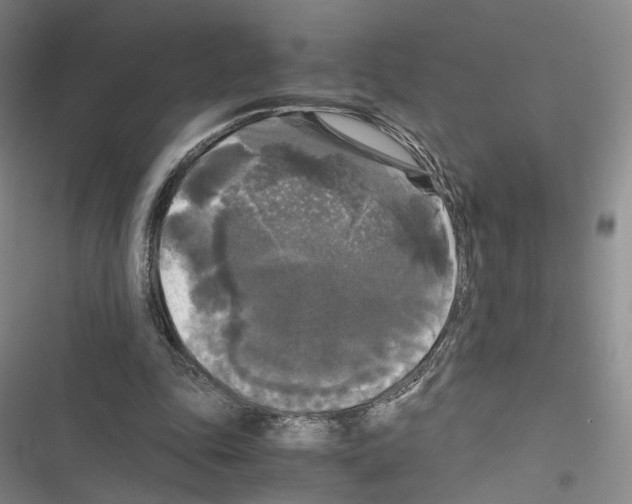 X0000116440343201001191536