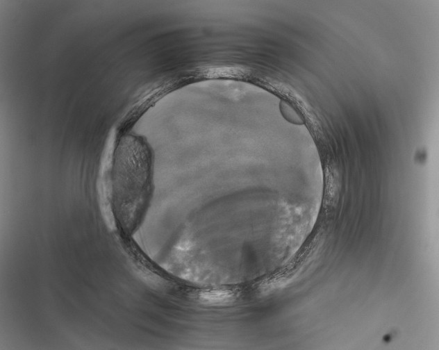 X0000116440357201001191536