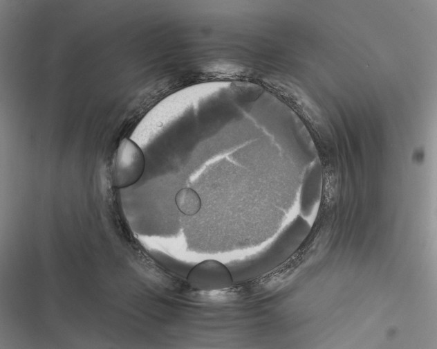 X0000116440365201001191537