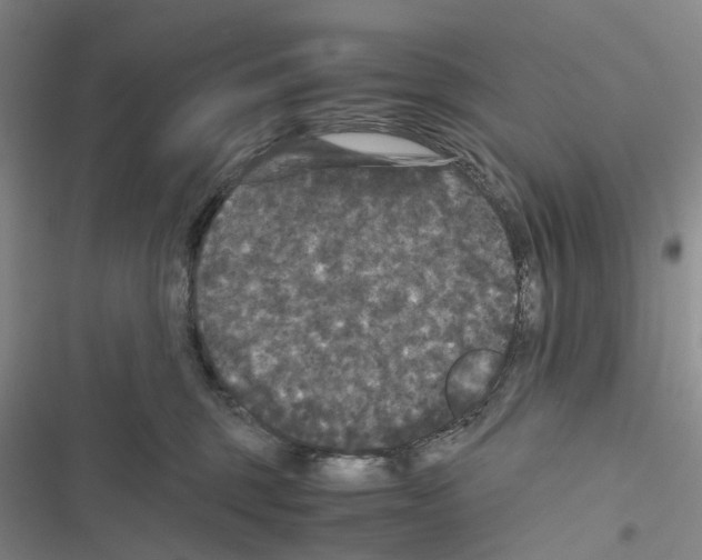 X0000116440375201001191537