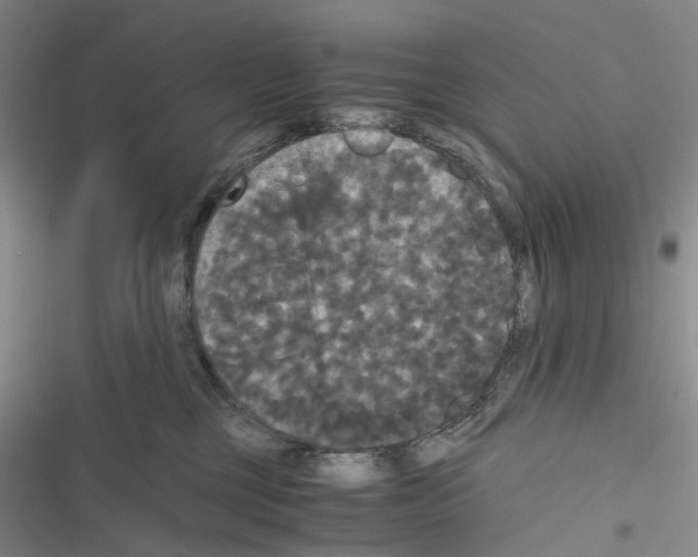 X0000116440377201001191537