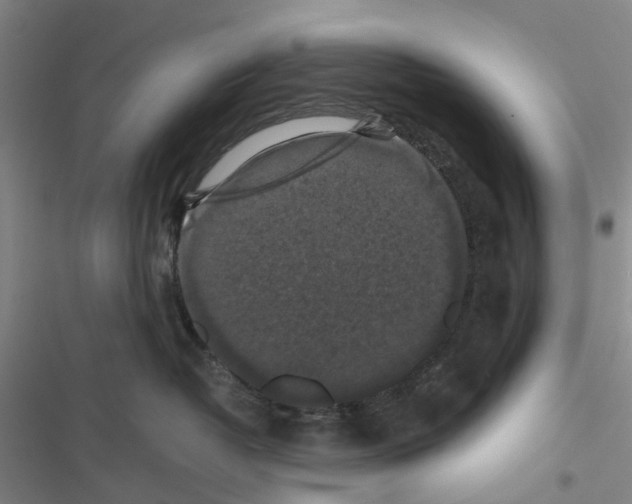 X0000116440382201001191537