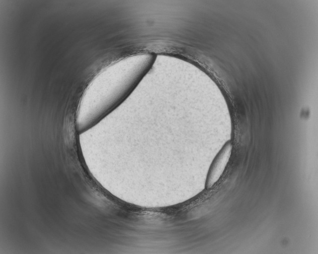 X0000116440393201001191536