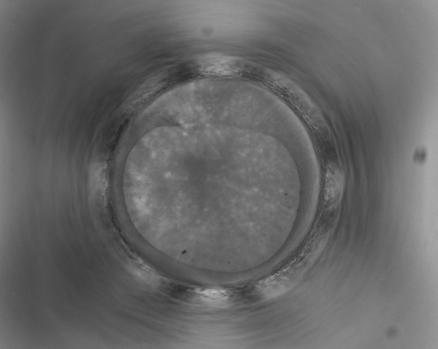 X0000116440409201001191536