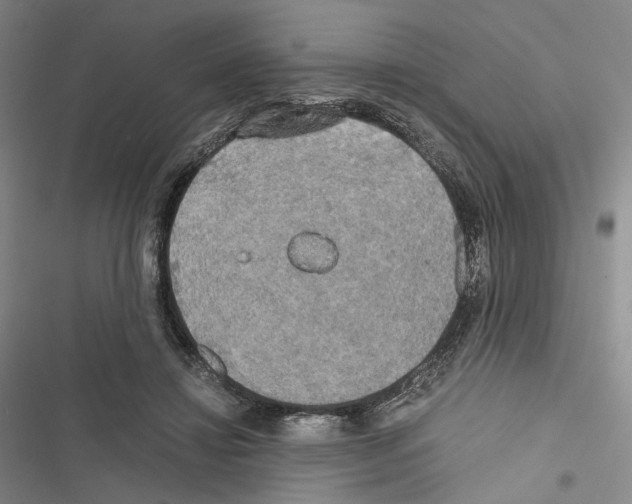 X0000116440452201001191535