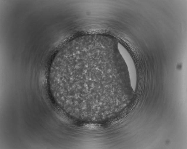 X0000116440499201001191535