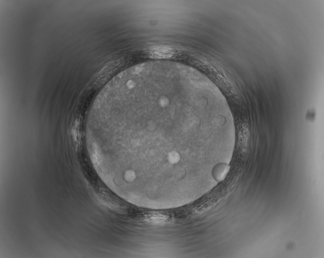 X0000116440598201001191533