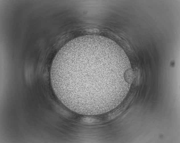 X0000116440614201001191533