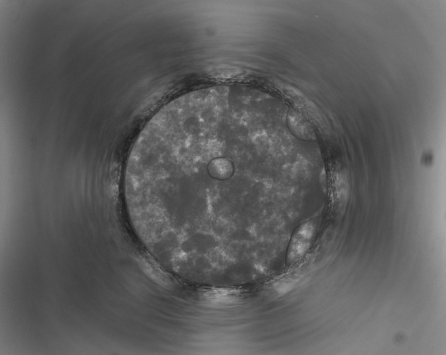 X0000116440664201001191533